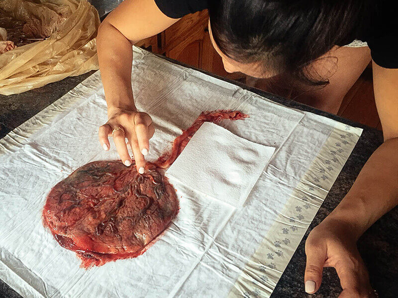 Making a placenta print
